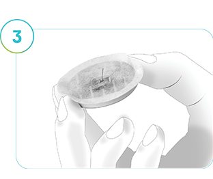 Slika, ki prikazuje merilnik SmartGuide za NMG, odstranjen iz kože