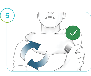 Slika prikazuje osebo, ki namešča nov senzor SmartGuide na novo mesto.