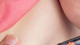 Vse o zdravem mestu injiciranja insulina